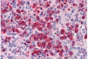 Spleen, Human: Formalin-Fixed, Paraffin-Embedded (FFPE) (ELANE anticorps)