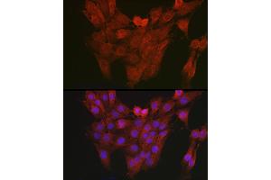 Immunofluorescence analysis of PC-12 cells using AHR antibody (ABIN3015499, ABIN3015500, ABIN5663909 and ABIN6218543) at dilution of 1:150.