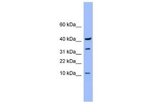 WB Suggested Anti-CASP6 Antibody Titration: 0. (Caspase 6 anticorps  (Middle Region))