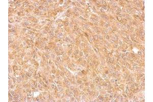 IHC-P Image AKR7A2 antibody detects AKR7A2 protein at cytosol on SkHep1 xenograft by immunohistochemical analysis.