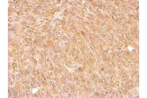 IHC-P Image AKR7A2 antibody detects AKR7A2 protein at cytosol on SkHep1 xenograft by immunohistochemical analysis. (AKR7A2 anticorps)