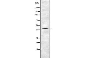 Western blot analysis of VN1R1 using HUVEC whole cell lysates (VN1R1 anticorps  (N-Term))