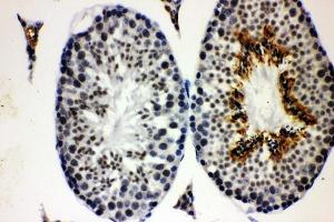 IHC analysis of CCNE1 using anti-CCNE1 antibody (ABIN7601193). (Cyclin E1 anticorps  (AA 3-386))