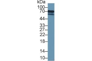 Detection of FOXC1 in 293T cell lysate using Polyclonal Antibody to Forkhead Box Protein C1 (FOXC1) (FOXC1 anticorps  (AA 62-186))