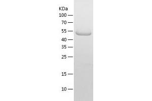Western Blotting (WB) image for ATG14 Autophagy Related 14 (ATG14) (AA 1-492) protein (His-IF2DI Tag) (ABIN7121919)