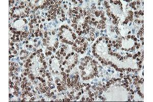 Image no. 6 for anti-Musashi Homolog 1 (Drosophila) (MSI1) antibody (ABIN1499571)