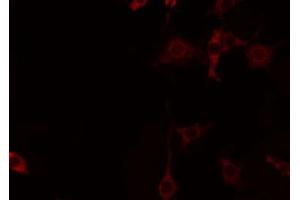 ABIN6274451 staining Hela by IF/ICC.