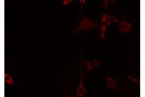 ABIN6274451 staining Hela by IF/ICC. (CNKSR2 anticorps  (Internal Region))