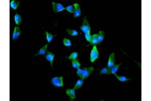 Immunofluorescence staining of SH-SY5Y cells with ABIN7168374 at 1:100, counter-stained with DAPI. (MEX3B anticorps  (AA 253-375))