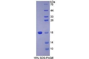 SDS-PAGE (SDS) image for Phospholipase A2, Group IIA (Platelets, Synovial Fluid) (PLA2G2A) (AA 21-144) protein (His tag) (ABIN2126300)