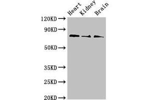 Western Blot Positive WB detected in: Mouse heart tissue, Mouse kidney tissue, Mouse brain tissue All lanes: SLC5A1 antibody at 4 μg/mL Secondary Goat polyclonal to rabbit IgG at 1/50000 dilution Predicted band size: 74, 61 kDa Observed band size: 74 kDa