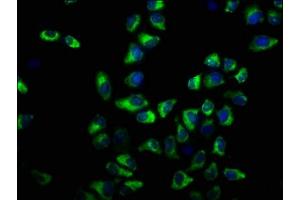Immunofluorescence staining of Hela cells with ABIN7163516 at 1:33, counter-stained with DAPI.