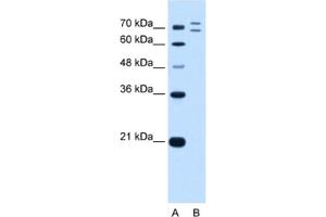 Western Blotting (WB) image for anti-Ring Finger Protein 168 (RNF168) antibody (ABIN2462696) (RNF168 anticorps)