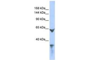 Image no. 1 for anti-Low Density Lipoprotein Receptor-Related Protein 1 (LRP1) (AA 211-260) antibody (ABIN6744286) (LRP1 anticorps  (AA 211-260))