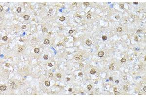Immunohistochemistry of paraffin-embedded Rat liver using CSNK2A1 Polyclonal Antibody at dilution of 1:100 (40x lens). (CSNK2A1/CK II alpha anticorps)