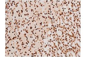 ABIN6267523 at 1/200 staining Rat ganstric tissue sections by IHC-P.