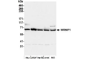 Western Blotting (WB) image for anti-Werner Helicase Interacting Protein 1 (WRNIP1) (AA 400-450) antibody (ABIN7454746)