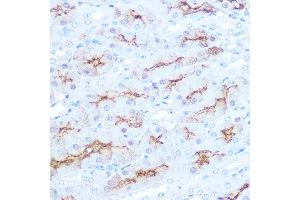 Immunohistochemistry of paraffin-embedded mouse kidney using CD138/Syndecan-1 Rabbit mAb (ABIN1683195, ABIN3018651, ABIN3018652 and ABIN7101639) at dilution of 1:100 (40x lens).