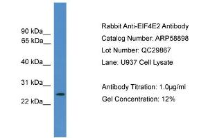 WB Suggested Anti-EIF4E2  Antibody Titration: 0. (EIF4E2 anticorps  (N-Term))
