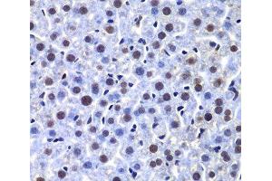 Immunohistochemistry of paraffin-embedded Mouse liver using PRKDC Polyclonal Antibody at dilution of 1:100 (40x lens). (PRKDC anticorps)