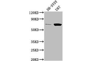 Western Blot Positive WB detected in: SH-SY5Y whole cell lysate, U87 whole cell lysate All lanes: TP73 antibody at 1:2000 Secondary Goat polyclonal to rabbit IgG at 1/50000 dilution Predicted band size: 70, 55, 54, 45, 62, 60, 65, 50, 48, 63, 39 kDa Observed band size: 70 kDa (Tumor Protein p73 anticorps  (AA 537-555))