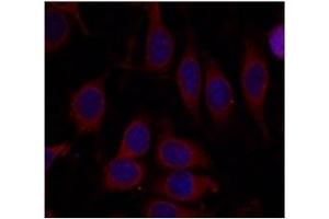 Image no. 3 for anti-Mechanistic Target of Rapamycin (serine/threonine Kinase) (mTOR) (Ser2448) antibody (ABIN319329)
