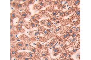 Used in DAB staining on fromalin fixed paraffin- embedded Kidney tissue