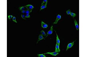 Immunofluorescent analysis of Hela cells using ABIN7175388 at dilution of 1:100 and Alexa Fluor 488-congugated AffiniPure Goat Anti-Rabbit IgG(H+L) (FLT4 anticorps  (AA 1112-1329))
