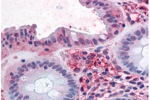 Human Colon: Formalin-Fixed, Paraffin-Embedded (FFPE) (SLC1A5 anticorps  (Internal Region))