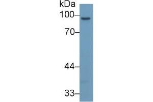 Detection of MMP9 in Rat Spleen lysate using Monoclonal Antibody to Matrix Metalloproteinase 9 (MMP9)