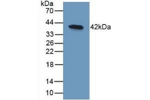 Detection of Recombinant BMP10, Human using Monoclonal Antibody to Bone Morphogenetic Protein 10 (BMP10) (BMP10 anticorps  (AA 315-424))