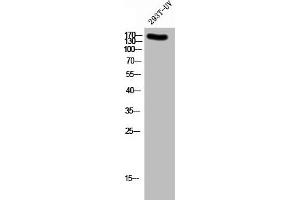 Western Blot analysis of 293T-UV cells using Phospho-NMDAε2 (Y1336) Polyclonal Antibody (GRIN2B anticorps  (pTyr1336))