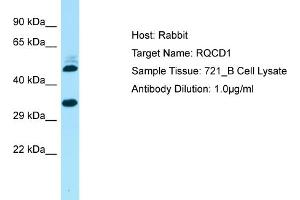 Host: Rabbit Target Name: RQCD1 Sample Type: 721_B Whole Cell lysates Antibody Dilution: 1. (RQCD1 anticorps  (Middle Region))