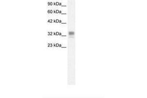Image no. 1 for anti-Asialoglycoprotein Receptor 1 (ASGR1) (AA 100-149) antibody (ABIN6736268) (Asialoglycoprotein Receptor 1 anticorps  (AA 100-149))