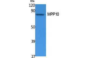 Western Blotting (WB) image for anti-M-Phase phosphoprotein 10 (U3 Small Nucleolar Ribonucleoprotein) (MPHOSPH10) (Internal Region) antibody (ABIN3178110) (MPHOSPH10 anticorps  (Internal Region))