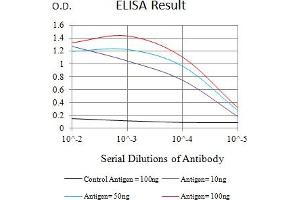 Black line: Control Antigen (100 ng),Purple line: Antigen (10 ng), Blue line: Antigen (50 ng), Red line:Antigen (100 ng)