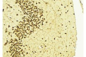 ABIN6268985 at 1/100 staining Mouse brain tissue by IHC-P.