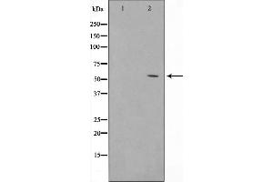 Western blot analysis of extracts from HeLa cells, treated with TSA 400nM 24h, using Acetyl-p53 (Lys317) Antibody.