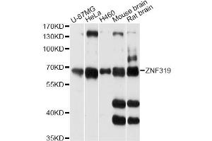 Western blot analysis of extracts of various cell lines, using ZNF319 antibody (ABIN6293846) at 1:3000 dilution.