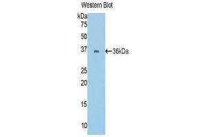 Western Blotting (WB) image for anti-Cadherin 1, Type 1, E-Cadherin (Epithelial) (CDH1) (AA 374-628) antibody (ABIN1858333)