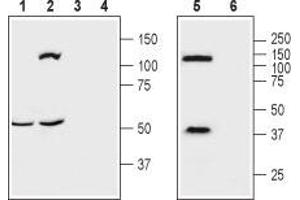 Western blot analysis of mouse brain (lanes 1 and 3), rat brain (lanes 2 and 4) and human brain neuroblastoma (SH-SY5Y) cell (lanes 5 and 6) lysates: - 1,2,5. (OPRK1 anticorps  (Extracellular, N-Term))