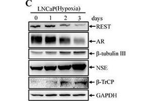 Hypoxia induces NED of LNCaP cells concomitant with down-regulation REST protein levels but not REST mRNA(A) LNCaP cells were treated with hypoxia (2 % O2) for 3 days. (BTRC anticorps)