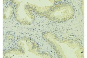 ABIN6272461 at 1/100 staining Mouse colon tissue by IHC-P.
