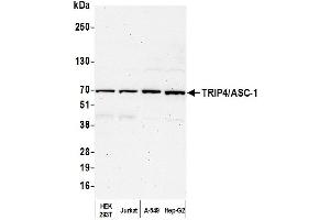 Western Blotting (WB) image for anti-Thyroid Hormone Receptor Interactor 4 (TRIP4) (AA 225-275) antibody (ABIN7450846)