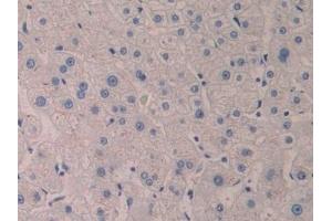 Detection of 5-LO in Human Liver Tissue using Polyclonal Antibody to 5-Lipoxygenase (5-LO) (ALOX5 anticorps  (AA 461-671))