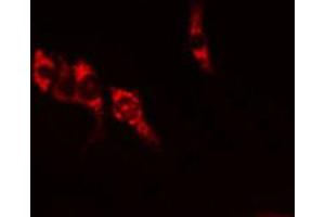 ABIN6269355 staining U-2 OS  cells by IF/ICC.