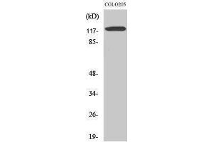 Western Blotting (WB) image for anti-Leptin Receptor (LEPR) (Internal Region) antibody (ABIN3185989) (Leptin Receptor anticorps  (Internal Region))