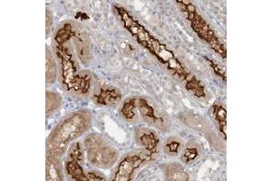 Immunohistochemical staining of human kidney with ATP11A polyclonal antibody  shows strong membranous and cytoplasmic positivity in cells in tubules. (ATP11A anticorps)