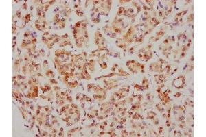 IHC image of ABIN7127416 diluted at 1:126. (Recombinant CDC5L anticorps)