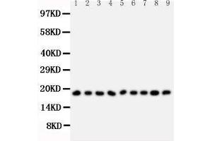 Anti-Ribonuclease A antibody, Western blotting All lanes: Anti Ribonuclease A  at 0. (RNASE1 anticorps  (Middle Region))